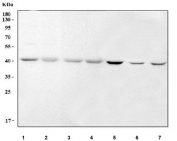 Western blot testing of 1) human ThP-1, 2) human K562, 3) human PC-3, 4) human HepG2, 5) rat testis and 6) rat C6 and 7) mouse NIH 3T3 cell lysate with RNA 3'-terminal phosphate cyclase antibody. Predicted molecular weight ~39 kDa.
