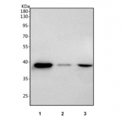 Western blot testing of human 1) RT4, 2) 293T and 3) A431 cell lysate with PP18 antibody. Predicted molecular weight: 34-44 kDa (multiple isoforms).