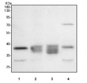 Western blot testing of 1) rat kidney, 2) rat heart, 3) rat stomach and 4) mouse kidney tissue lysate with PP18 antibody. Predicted molecular weight: 34-44 kDa (multiple isoforms).
