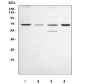 Western blot testing of human 1) HepG2, 2) A549, 3) MCF7 and 4) HUH7 cell lysate with Insulin-induced gene 1 antibody. Predicted molecular weight ~30 kDa with a 66-70 kDa precursor.