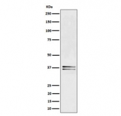 Western blot testing of human Jurkat cell lysate with LAT antibody. Expected molecular weight: 36-38 kDa.