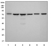 Western blot testing of 1) human HaCaT, 2) human HeLa, 3) human ThP-1, 4) human SH-SY5Y, 5) rat brain and 6) mouse brain tissue lysate with LCMT2 antibody. Predicted molecular weight ~76 kDa.