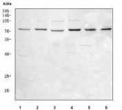 Western blot testing of 1) human 293T, 2) human SH-SY5Y, 3) human MCF7, 4) human K562, 5) human Caco-2 and 6) mouse RAW264.7 cell lysate with LRCH4 antibody. Predicted molecular weight ~74 kDa.