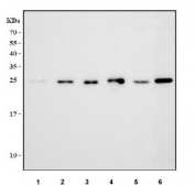 Western blot testing of 1) human HeLa, 2) human K562, 3) human HEL, 4) human RT4, 5) rat liver and 6) mouse liver tissue lysate with Lysophospholipase 1 antibody. Predicted molecular weight ~25 kDa.