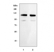 Western blot testing of human 1) K562 and 2) HEL cell lysate with LRIG2 antibody. Predicted molecular weight ~119 kDa.