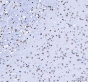 IHC staining of FFPE rat brain tissue with LUC7L3 antibody. HIER: boil tissue sections in pH8 EDTA for 20 min and allow to cool before testing.
