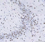 IHC staining of FFPE rat brain tissue with LUC7L3 antibody. HIER: boil tissue sections in pH8 EDTA for 20 min and allow to cool before testing.