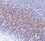 IHC staining of FFPE rat stomach tissue with LYPLA2 antibody. HIER: boil tissue sections in pH8 EDTA for 20 min and allow to cool before testing.