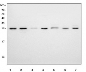 Western blot testing of 1) human SH-SY5Y, 2) human HepG2, 3) human HeLa, 4) human HEL, 5) rat brain, 6) rat stomach and 7) mouse brain tissue lysate with LYPLA2 antibody. Predicted molecular weight ~25 kDa.
