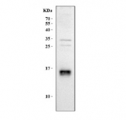 Western blot testing of human HeLa cell lysate with LDOC1 antibody. Predicted molecular weight ~17 kDa.