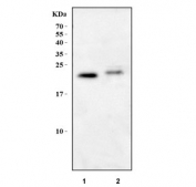 Western blot testing of 1) rat small intestine and 2) mouse spleen tissue lysate with JCHAIN antibody. Predicted molecular weight ~18 kDa but may be observed at higher molecular weights due to glycosylation.