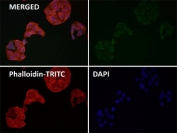Immunofluorescent staining of FFPE human HeLa cells with FDX1 antibody (green), Phalloidin (red) and DAPI nuclear stain (blue). HIER: steam section in pH6 citrate buffer for 20 min.