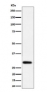 Western blot testing of human LnCaP cell lysate with N-acetyltransferase 1 antibody. Predicted molecular weight ~34 kDa.