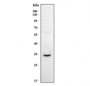Western blot testing of human HepG2 cell lysate with MPST antibody. Predicted molecular weight: 33-35 kDa (two isoforms).