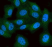 Immunofluorescent staining of FFPE human PC-3 cells with MPST antibody (green) and DAPI nuclear stain (blue). HIER: steam section in pH6 citrate buffer for 20 min.