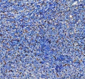 IHC staining of FFPE human tonsil tissue with Leucine aminopeptidase 3 antibody. HIER: boil tissue sections in pH8 EDTA for 20 min and allow to cool before testing.