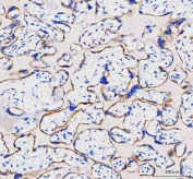 IHC staining of FFPE human placental tissue with IDUA antibody. HIER: boil tissue sections in pH8 EDTA for 20 min and allow to cool before testing.