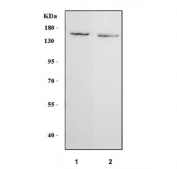 Western blot testing of human 1) K562 and 2) HeLa cell lysate with IARS1 antibody. Predicted molecular weight ~144 kDa.