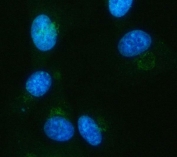 Immunofluorescent staining of FFPE human PC-3 cells with IDH3A antibody (green) and DAPI nuclear stain (blue). HIER: steam section in pH6 citrate buffer for 20 min.
