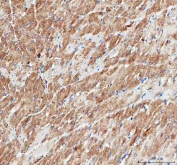 IHC staining of FFPE rat heart tissue with IDH3A antibody. HIER: boil tissue sections in pH8 EDTA for 20 min and allow to cool before testing.
