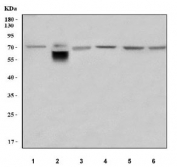 Western blot testing of 1) human Jurkat, 2) human placenta, 3) human Caco-2, 4) rat liver, 5) mouse liver and 6) mouse NIH 3T3 cell lysate with Lumican antibody. Predicted molecular weight ~38 kDa but may be observed at higher molecular weights due to glycosylation.