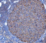 IHC staining of FFPE mouse ovary tissue with Diphosphomevalonate decarboxylase antibody. HIER: boil tissue sections in pH8 EDTA for 20 min and allow to cool before testing.
