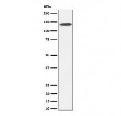 Western blot testing of human HepG2 cell lysate with CDH4 antibody. Expected molecular weight: 100-140 kDa depending on glycosylation level.