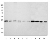 Western blot testing of 1) human HeLa, 2) human PC-3, 3) human T-47D, 4) human A549, 5) human A431, 6) human U-937, 7) human MCF7, 8) rat brain, 9) mouse brain and 10) mouse lung tissue lysate with RAB14 antibody. Predicted molecular weight ~24 kDa.