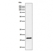 Western blot testing of human Jurkat cell lysate with UBE2L3 antibody. Predicted molecular weight ~18 kDa.