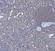 IHC staining of FFPE human spleen tissue with RPL18 antibody. HIER: boil tissue sections in pH8 EDTA for 20 min and allow to cool before testing.
