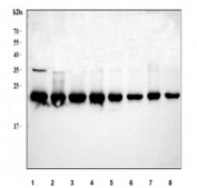 Western blot testing of 1) human HeLa, 2) human 293T, 3) human HepG2, 4) human Daudi, 5) rat testis, 6) rat brain, 7) mouse testis and 8) mouse brain tissue lysate with RPL18 antibody. Predicted molecular weight ~22 kDa.
