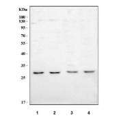 Western blot testing of 1) human Jurkat, 2) human HepG2, 3) rat brain and 4) mouse brain tissue lysate with IFFO1 antibody. Predicted molecular weight ~23 kDa, 28 kDa and 62 kDa (multiple isoforms).