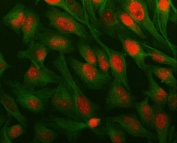 Immunofluorescent staining of FFPE human HeLa cells with ESO-3 antibody (red) and Beta Tubulin mAb (green). HIER: steam section in pH6 citrate buffer for 20 min.