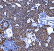 IHC staining of FFPE mouse ovary tissue with MELK antibody. HIER: boil tissue sections in pH8 EDTA for 20 min and allow to cool before testing.