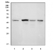 Western blot testing of 1) human 293T, 2) rat heart, 3) rat RH35 and 4) mouse heart tissue lysate with Pyruvate dehydrogenase kinase 1 antibody. Predicted molecular weight ~49 kDa.