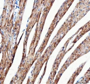 IHC staining of FFPE mouse heart tissue with Mitofilin antibody. HIER: boil tissue sections in pH8 EDTA for 20 min and allow to cool before testing.