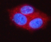 Immunofluorescent staining of FFPE human HepG2 cells with MOGAT2 antibody (red) and DAPI nuclear stain (blue). HIER: steam section in pH6 citrate buffer for 20 min.