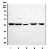 Western blot testing of 1) human HepG2, 2) human 293T, 3) rat liver, 4) rat kidney and 5) mouse kidney tissue lysate with MOGAT2 antibody. Predicted molecular weight ~38 kDa.