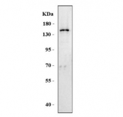 Western blot testing of human Jurkat cell lysate with PARP10 antibody. Predicted molecular weight ~110 kDa but can be observed at up to ~150 kDa.
