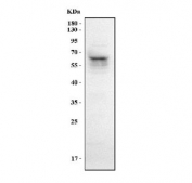 Western blot testing of human 293T cell lysate with LIN9 antibody. Predicted molecular weight: 58-64 kDa (multiple isoforms).