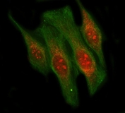 Immunofluorescent staining of FFPE human HeLa cells with LIN9 antibody (red) and Beta Tubulin mAb (green). HIER: steam section in pH6 citrate buffer for 20 min.