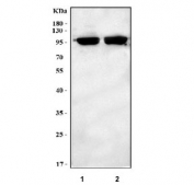 Western blot testing of 1) rat skeletal muscle and 2) mouse skeletal muscle tissue lysate with LRRN1 antibody. Predicted molecular weight ~81 kDa but may be observed at higher molecular weights due to glycosylation.
