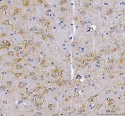 IHC staining of FFPE rat brain tissue with LRRN1 antibody. HIER: boil tissue sections in pH8 EDTA for 20 min and allow to cool before testing.