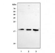 Western blot testing of human 1) RT4, 2) MCF7 and 3) SiHa cell lysate with LYPD6 antibody. Predicted molecular weight ~19 kDa.