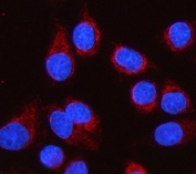 Immunofluorescent staining of FFPE human SiHa cells with LGI4 antibody (red) and DAPI nuclear stain (blue). HIER: steam section in pH6 citrate buffer for 20 min.