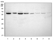 Western blot testing of 1) human HepG2, 2) human HaCaT, 3) human SiHa, 4) human U-251, 5) rat brain, 6) rat stomach, 7) mouse brain and 8) mouse stomach tissue lysate with LGI4 antibody. Predicted molecular weight ~59 kDa.