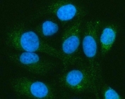 Immunofluorescent staining of FFPE human HeLa cells with Pellino-3 antibody (green) and DAPI nuclear stain (blue). HIER: steam section in pH6 citrate buffer for 20 min.