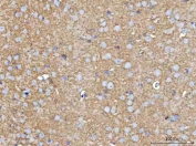 IHC staining of FFPE mouse brain tissue with MOSPD2 antibody. HIER: boil tissue sections in pH8 EDTA for 20 min and allow to cool before testing.