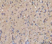 IHC staining of FFPE rat brain tissue with MOSPD2 antibody. HIER: boil tissue sections in pH8 EDTA for 20 min and allow to cool before testing.