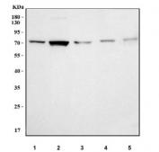 Western blot testing of 1) human Jurkat, 2) human RT-4, 3) human SiHa, 4) rat liver and 5) mouse liver tissue lysate with PXYLP1 antibody. Predicted molecular weight ~55 kDa but may be observed at higher molecular weights due to glycosylation.